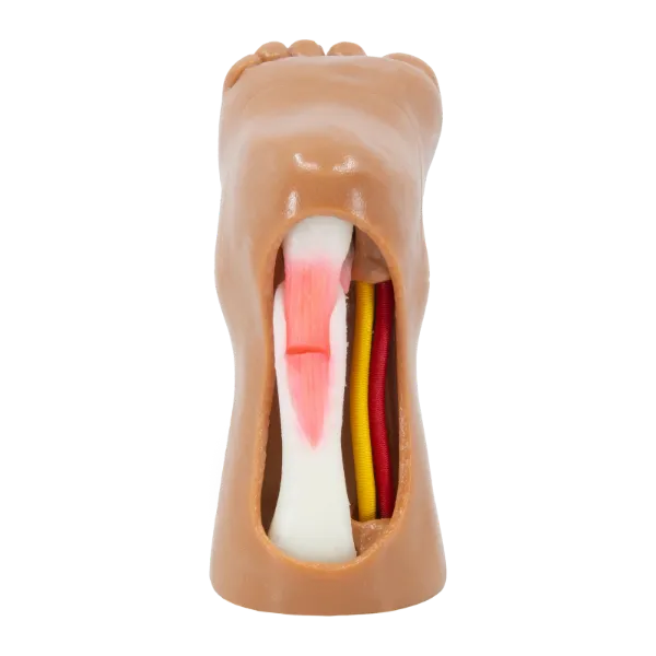 Tenotomy Model