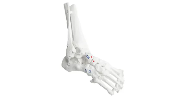 Ponseti® Clubfoot Model